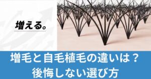 増毛と自毛植毛の違い!どちらを選ぶ?後悔しない選び方ガイドのアイキャッチ画像