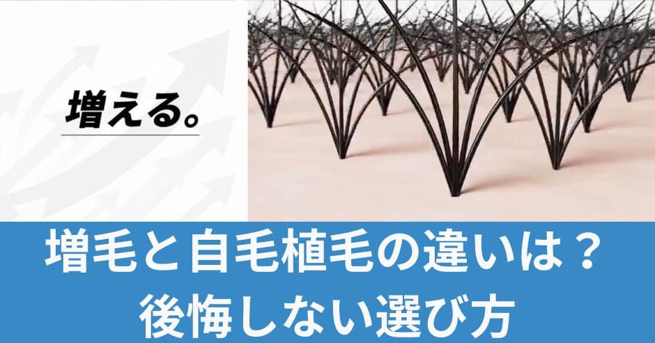 増毛と自毛植毛の違い！どちらを選ぶ？後悔しない選び方ガイドのアイキャッチ画像